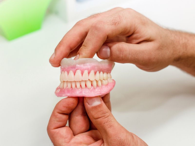 La trasformazione del sorriso attraverso le protesi dentali: una guida completa