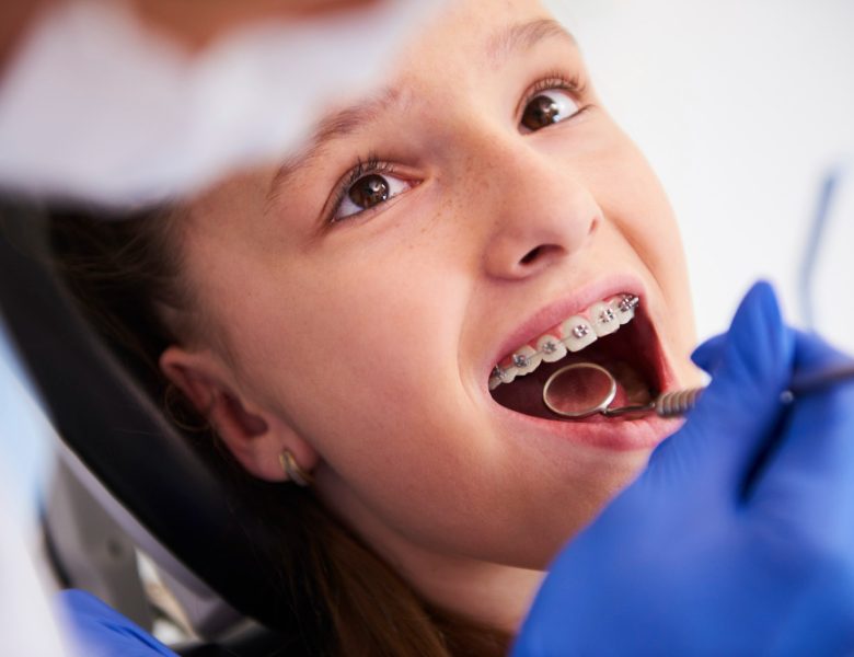 Riconquista il tuo sorriso: l’innovativo approccio dell’Ortodonzia Ruggiero a Nola