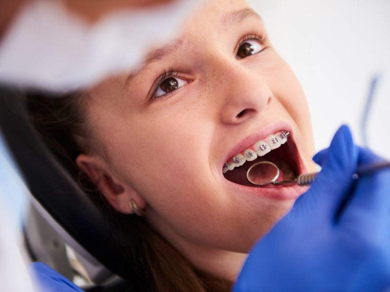 Riconquista il tuo sorriso: l’innovativo approccio dell’Ortodonzia Ruggiero a Nola