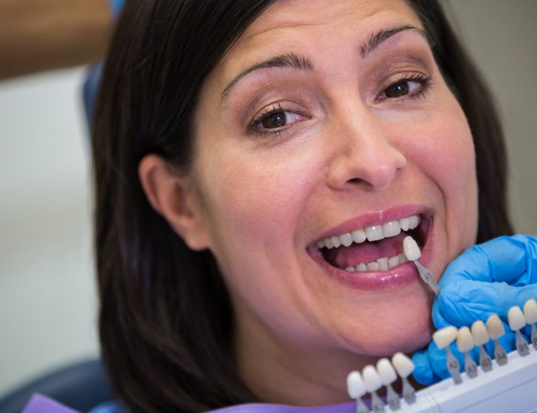 Impianti Dentali a Roma: Guida alla Procedura e ai Tempi di Realizzazione