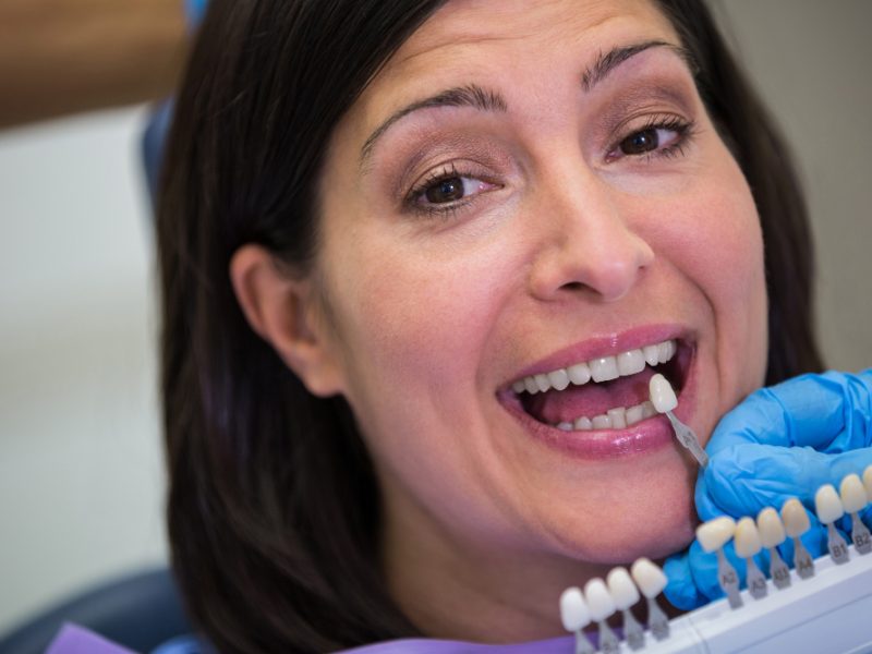 Impianti Dentali a Roma: Guida alla Procedura e ai Tempi di Realizzazione
