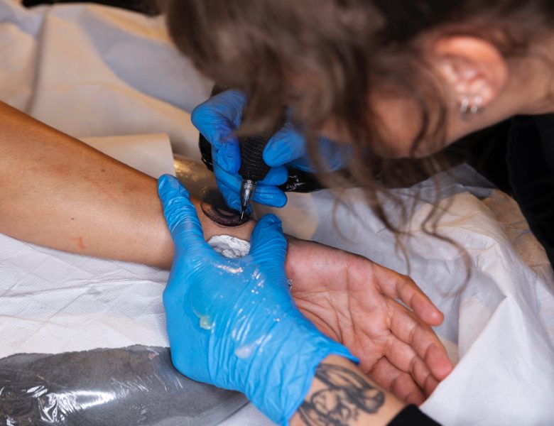 Rimozione tatuaggi laser a Brescia: perché questo servizio è fondamentale